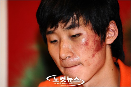 <b>박철우 선수</b> 폭행 사건, "국가대표도, 프로선수도 피해갈 수... 