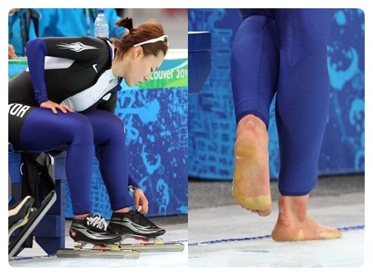 김연아 발, 박지성 발, 강수진 발, 고통과 인내의 시간을 말해주다