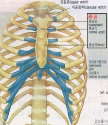 흉선종(胸線腫), 흉선암(胸線癌)과 차가버섯 : 네이버 블로그