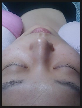 반영구속눈썹연장술 반영구속눈썹연장술
