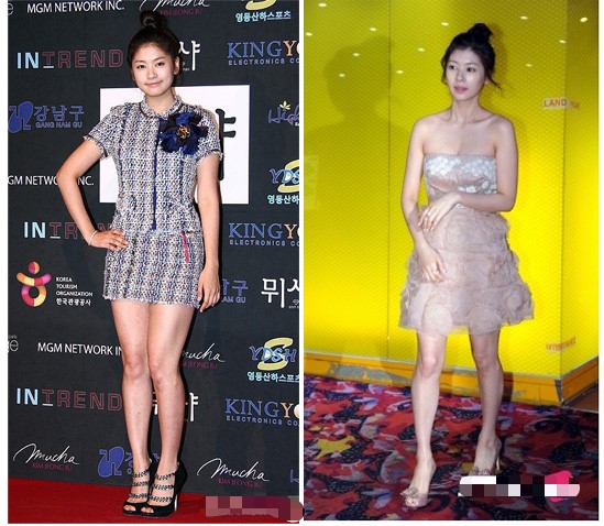 ì •ì†Œë¯¼ ë‹¤ì´ì–´íŠ¸ ì„±ê³µ ë‹¤ë¦¬ì— ëª° í•œê±°ì•¼ ì •ì†Œë¯¼ ë‹¤ë¦¬ ë¹„êµë¶„ì„ ë„¤ì´ë²„ ë¸