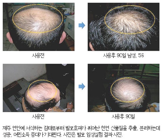 [프로카바 샴푸]제주 감태 추출물이 함유된 프로카바 샴푸의 놀라운 발모효능