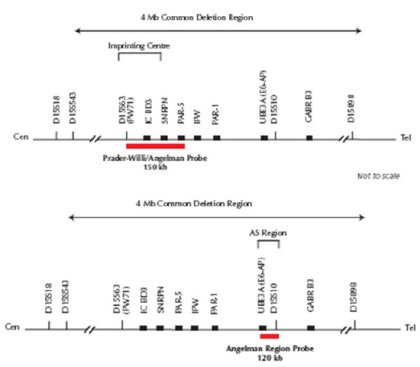 엔젤만 증후군을 앓고 있는 성인
