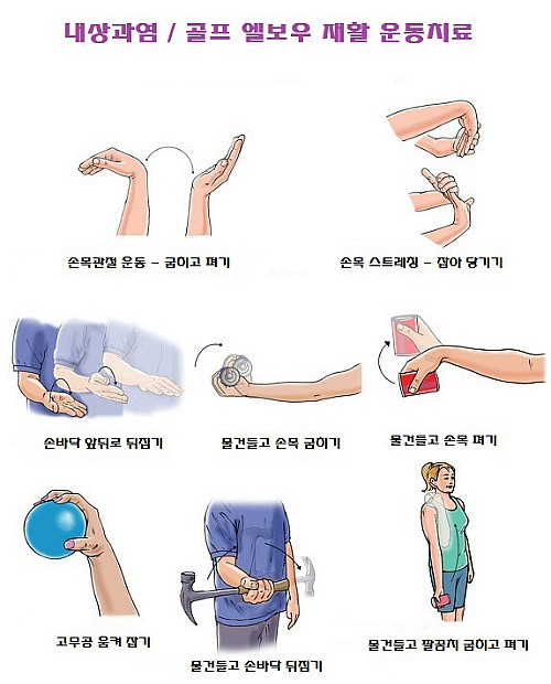 <<b>금곡동 정형외과</b>> 골프 & 테니스 엘보우 -상과염의 재활치료