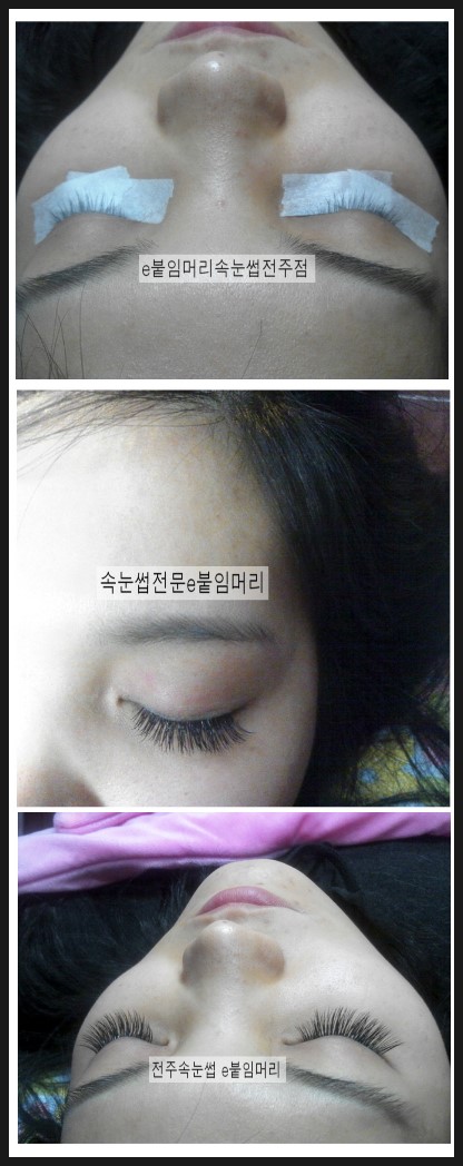전주속눈썹증모술 전주속눈썹증모술