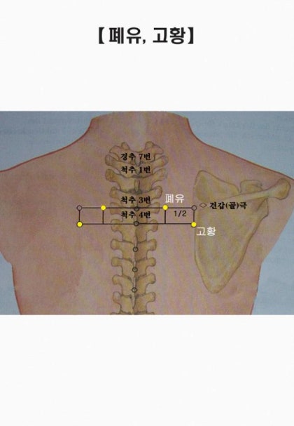 무극보양뜸 -뜸자리 찾기(그림)과 뜸효과(Ebs방송) : 네이버 블로그