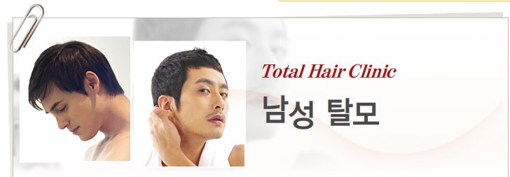 울산탈모관리 울산모발이식 더블레스 남성탈모관리