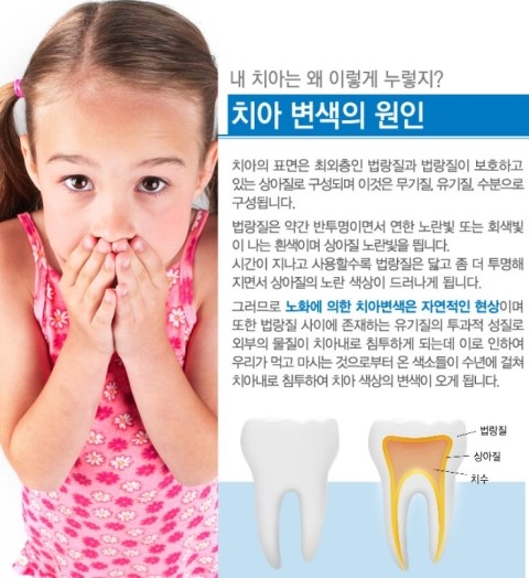 [치아미백] 밝고 환한 치아 만드는 원데이 치아미백!
