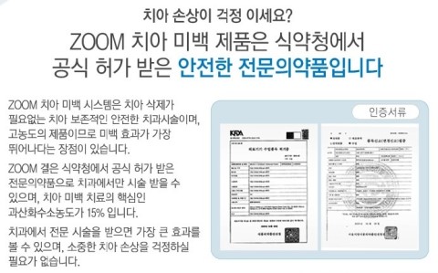  앞니치아미백