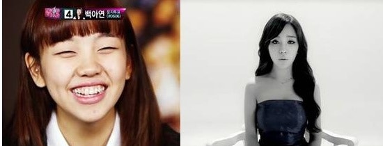 백아연 라미네이트 효과대박!!