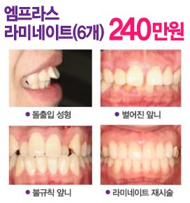  라미네이트＊라미네이트비용＊라미네이트가격