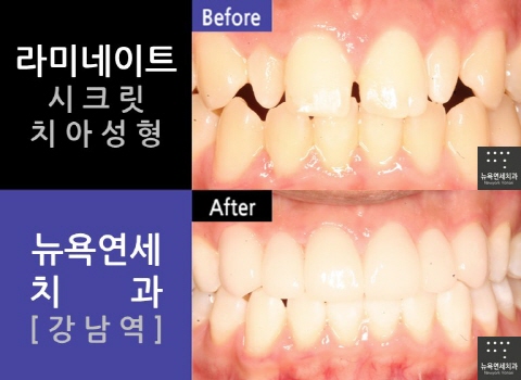  라미네이트 가격