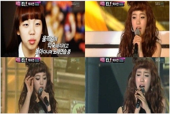 백아연 라미네이트로 예뻐지다!
