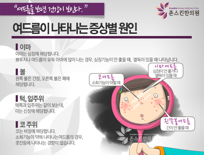 수원 인계동 피부과 한의원 치료도 잘합니다. 2