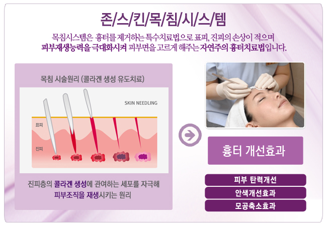 수원 인계동 피부과 한의원 치료도 잘합니다.