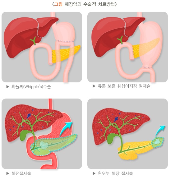 ì·Œìž¥ì•
