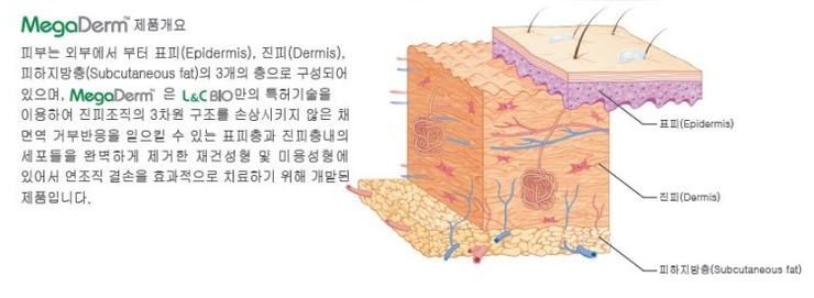  대체진피 랑 저장진피 차이점이 뭐에요 ?!! 정확히 