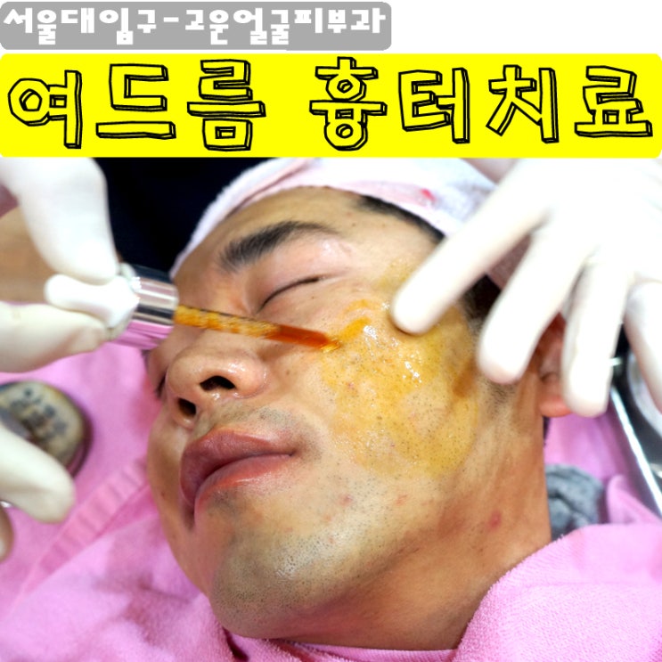  여드름흉터치료 / 서울대입구 피부과 