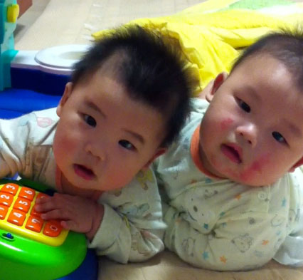  우리아들 아토피 증상 나타나다...
