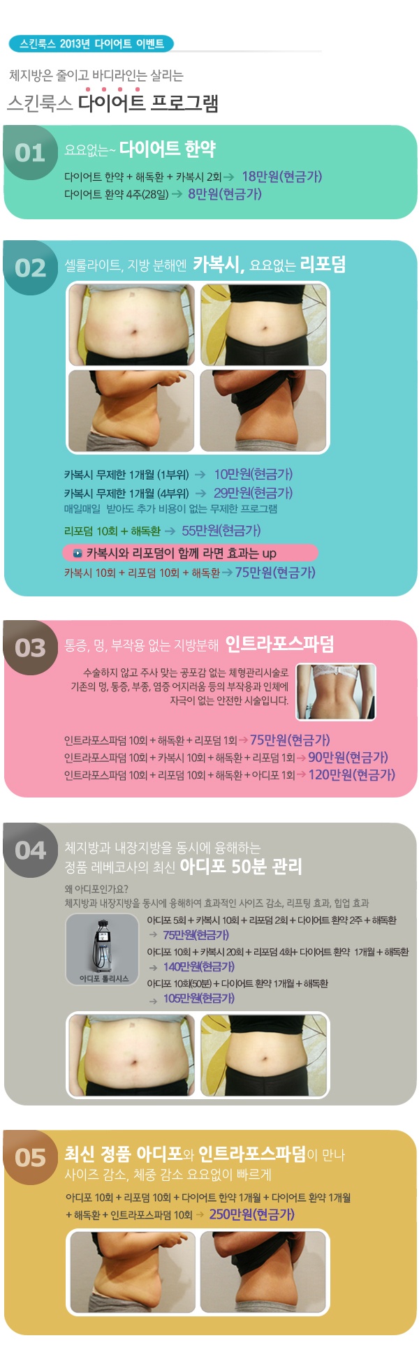 남성지방흡입비용 평균가격과 고주파지방분해(RFAL)효과 남성지방흡입비용 평균가격과 고주파지방분해(RFAL)효과