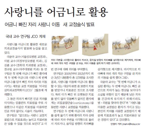  사랑니를 어금니로 활용