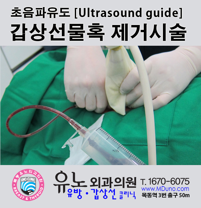 [병원/외과] 갑상선 수혹제거 리뷰 (2)-5cm이상 병원 4곳 방문(+마이머니내산, 솔직후기)