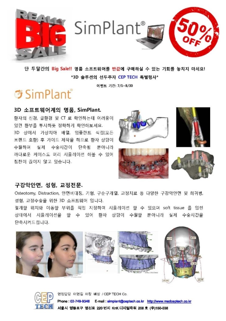 3D 소프트웨어계의 명품, 심플란트 단 두달간 반값 프로모션. (7/1~8/30까지), 3D 프린터 프로젯 MP, DP