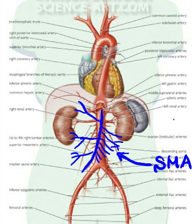 배안의 동맥 혈전 색전 Sma Embolism 네이버 블로그