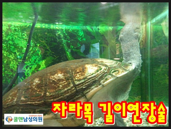  (남양주 비뇨기과/ 남양주 남성수술) 쿨맨 천호점 길이연장술       -    강동구길이연장/천호길이연장/구리길이연장/남양주길이연장/중랑구길이연장/하남길이연장/성남길이연장/광진구길이연장/송파구길이연장/가평길이연장/포천길이연장/강원도길이연장/경기도길이연장