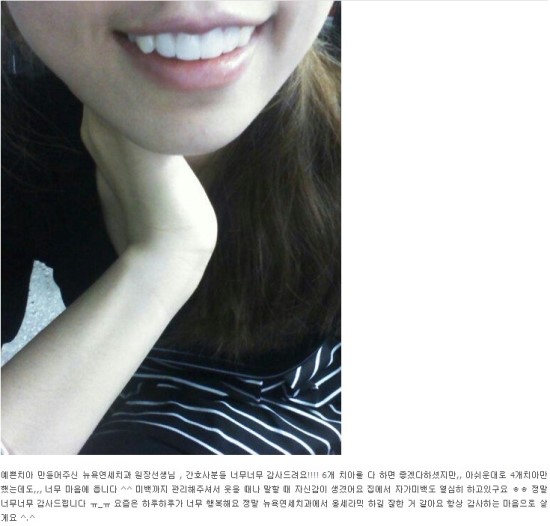  [뉴욕연세치과 이벤트] 시술후기 쓰고 터치업미백을 받아 보세요!!