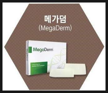  (구리 비뇨기과/ 구리 남성수술) 쿨맨남성의원 메가덤확대    -   강동구메가덤확대/천호메가덤확대/구리메가덤확대/남양주메가덤확대/중랑구메가덤확대/하남메가덤확대/성남메가덤확대/광진구메가덤확대/송파구메가덤확대/가평메가덤확대/포천메가덤확대/강원도메가덤확대/경기도메가덤확대