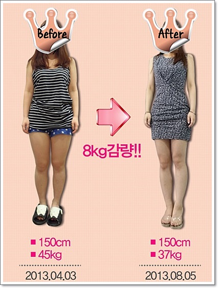 하체비만다이어트 Ppc주사후기 네이버 블로그