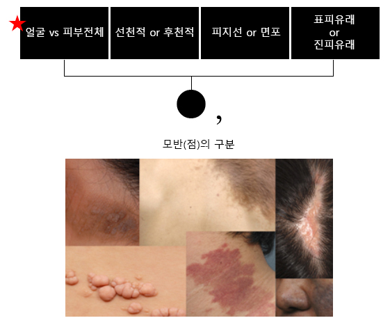 [얼굴점,모반]맞춤 레이저 시술로 흉터/자국없이 깨끗하게 제거해줍니다. 2