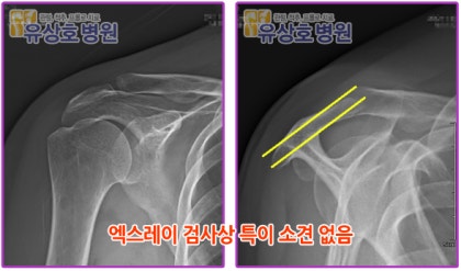 성남, 위례오십견 부근에서 치료를 위한 검사부터