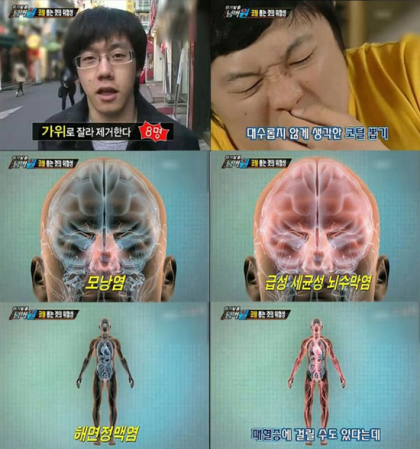 코털 뽑다가 사망 !!! [안면부 위험삼각 / Danger Triangle] : 네이버 블로그