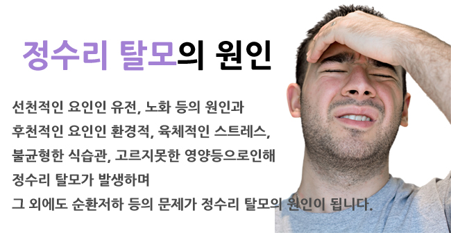의정부탈모 범위와 개수가 각각 5