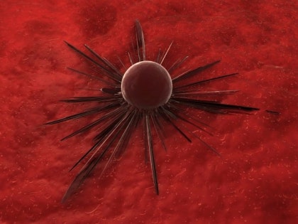 십이지장성 십이지장종 형태 표지