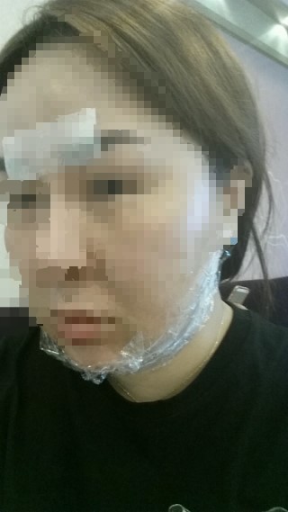 전주 삼성로하스의원 윤곽주사 달걀주사 후기 전주 삼성로하스의원 윤곽주사 달걀주사 후기