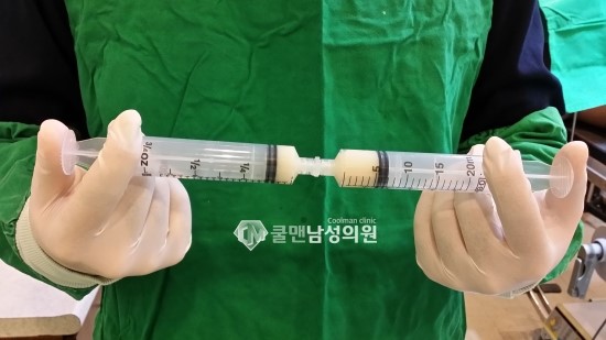  (구리 비뇨기과/구리 음경확대) 귀두확대, 음경확대 재료 "메가필"    -   강동구메가필확대/천호메가필확대/구리메가필확대/남양주메가필확대/중랑구메가필확대/하남메가필확대/성남메가필확대/광진구메가필확대/송파구메가필확대/가평메가필확대/포천메가필확대/강원도메가필확대