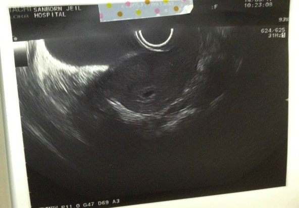 임신 5주 _  기특이와 처음 만난 날♡