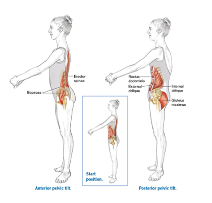 하체비만/다이어트] 다리가 굵어보이는 원인? 골반전방경사가 그 원인 중하나? 해결책. : 네이버 블로그