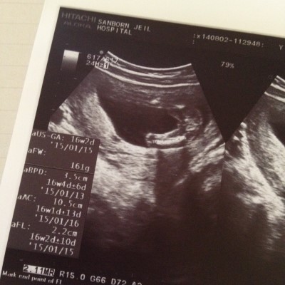 임신 16주4일차 _ 기특이 성별, 쿼드검사