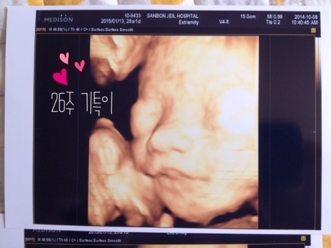 임신 26주1일차 _ 임당검사, 기특이 얼굴 공개♡