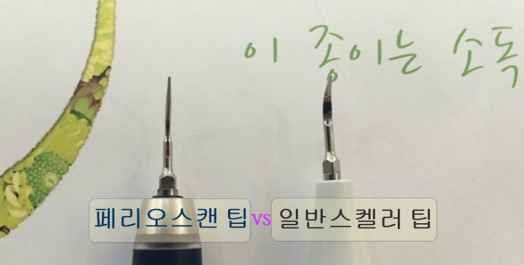  보험되는 안아픈 스켈링