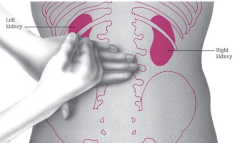 등을 두드리면 아픈 증상, 갈비 6