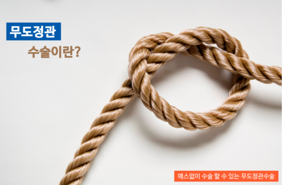  (강동구 정관수술/송파구 정관수술) 매스 없이 수술을 할 수 있는 무도정관수술