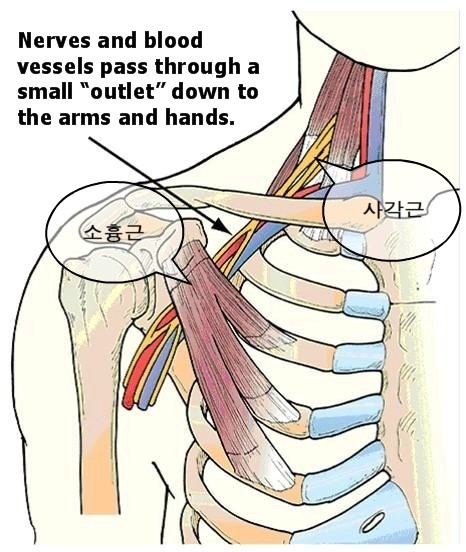 [송파구 한의원/주말진료/오십견 흉곽출구 증후군 침치료] 족태음비경_주영 周榮 SP20