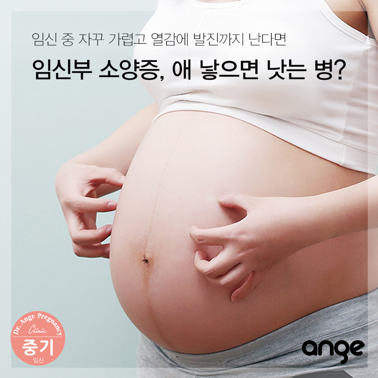 임신부 가려움증 완화법 지켜야 할 점은?