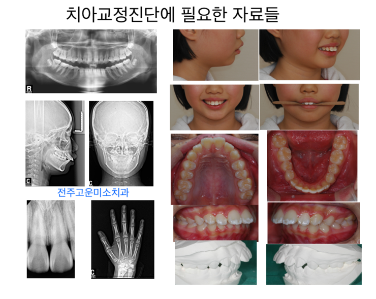 전주치 교정디테일까지 꼼꼼하게 다듬으면서