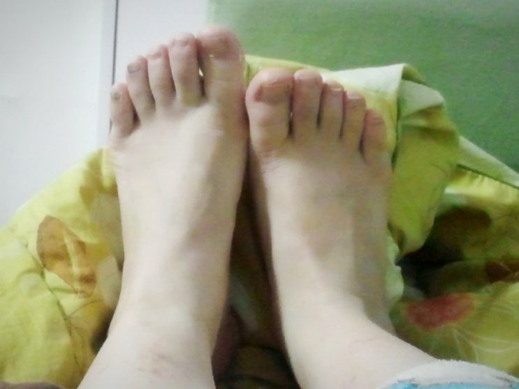  39주5일...아침이를 기다리며